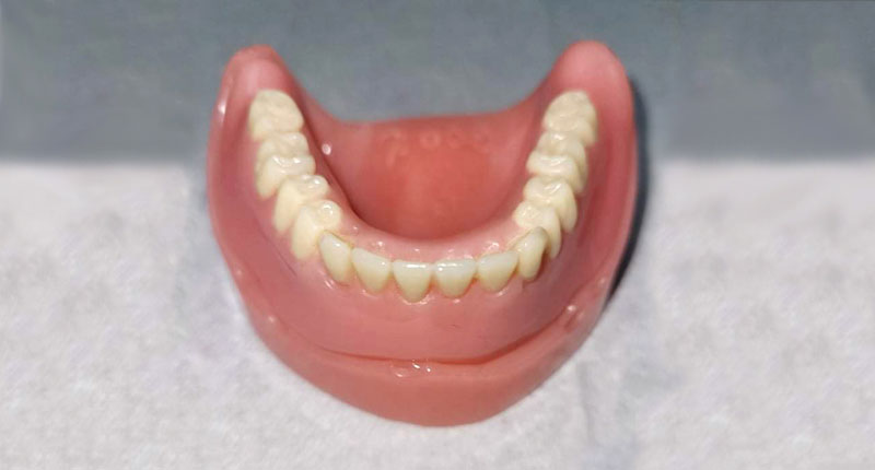 Lower dentures